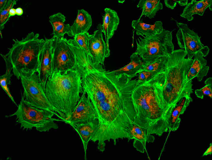 AF ��(bi��o)��(zh��n) �ɹ�V��K