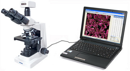 MIA-V����Ӌ��(sh��)�x/���������x/�ΑB(t��i)�W����