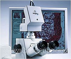 �@΢�����õ�(gu��)ProgRes���I(y��)CCD