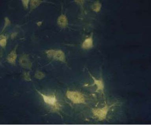 Hydroxystilbamidine (�ɹ��)