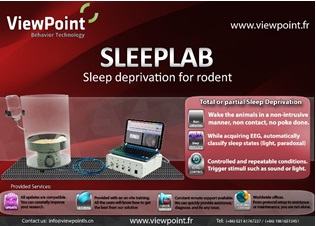 ��(d��ng)��˯�߄��Zԇ�(y��n)ϵ�y(t��ng) - Sleep Deprivation