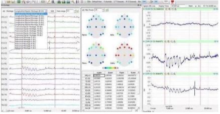 iWorx �X늜y(c��)��ϵ�y(t��ng)