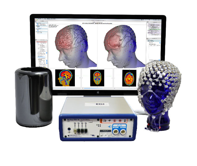 EGI��(j��ng)�B���(j��ng)�{(di��o)��ϵ�y(t��ng)