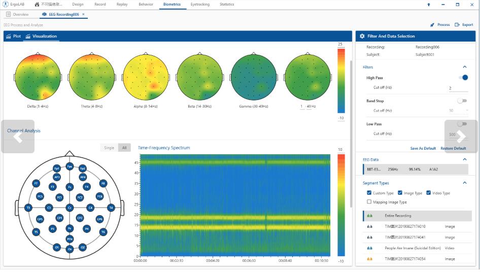 EEG�X늷���ܛ��