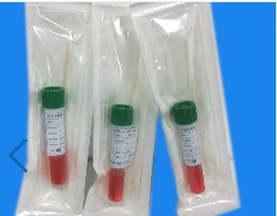 �����ɘӹܣ��\�����B(y��ng)����