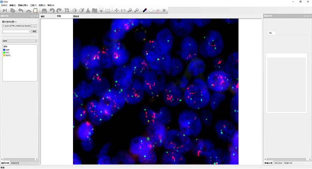 MFISH�ɹ�ԭλ�s������ϵ�y(t��ng)