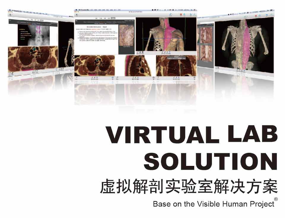 VH Dissector ̓�M���ʌ�(sh��)�(y��n)��