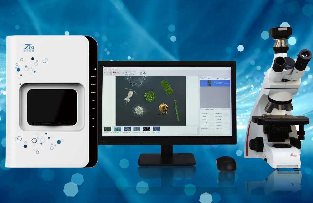 ����Ӌ��(sh��)���־�Ȧ�y��Ч�r���@΢��(x��)�������x