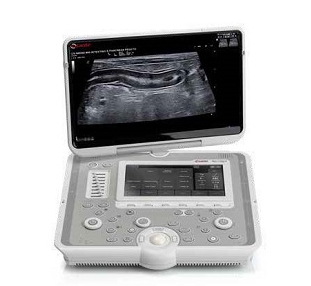 ��������ϵ�y(t��ng)���߷ֱ��ʴ���Ӱ��