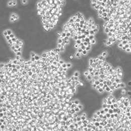 С��κ˾��ɼ�����Ѫ������RAW 264.7