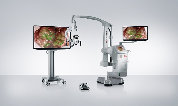 ARveo 8��(sh��)�ֻ����g(sh��)�@΢�R