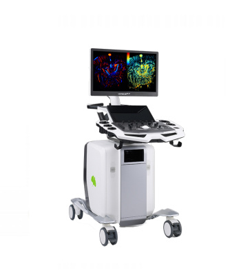 С��(d��ng)�ﳬ�ֱ泬����ϵ�y(t��ng)