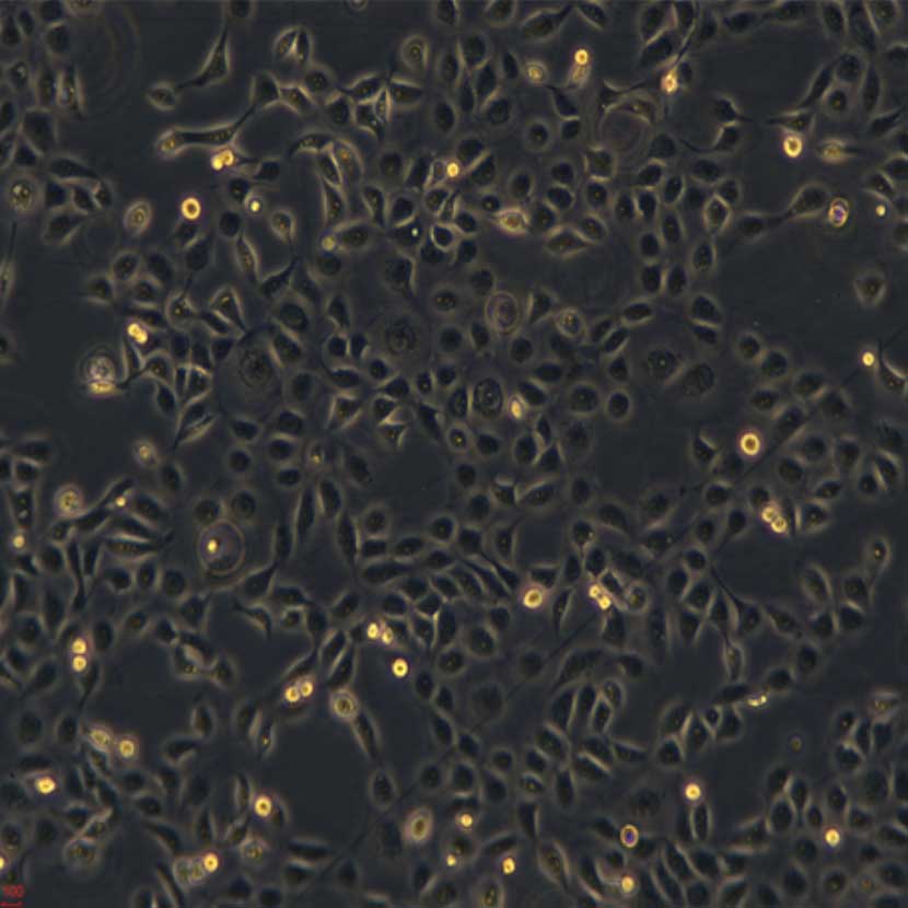 �˽�Ĥ��Ƥ���� ������ HCE-T �F(xi��n)؛