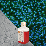 ��������Ě�o�}��Ƥ������HUVEC��