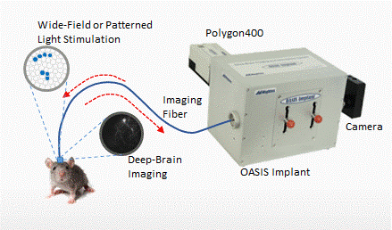 OASIS Implant���w���w����ϵ�y(t��ng)