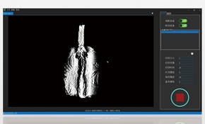 X-Tomer��ӡ����ܛ��