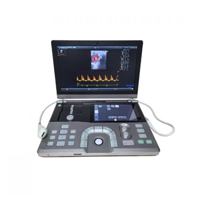 D10 LAB  ��y�߶�С��(d��ng)�ﳬ����ϵ�y(t��ng)