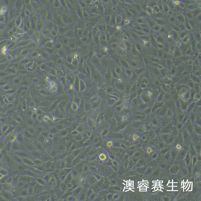 HUV-EC-C [HUVEC]����Ě�o�}Ѫ�܃�(n��i)Ƥ������