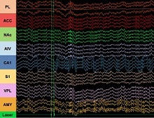 ��С����X�^(q��)���λ��̖�ɼ�