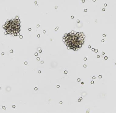 Raji����Burkitt's�ܰ�������