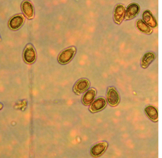 ΢���ﳬ�߉�̎��ǰ