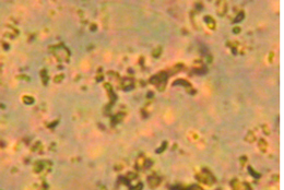 ΢���ﳬ�߉�̎����