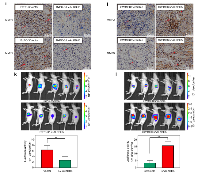 ALKBH5�� ������ai�������L���D(zhu��n)��
