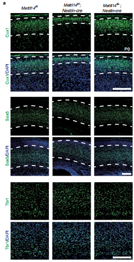 Mettl14ȱʧ��(d��o)�����ڳ�����(j��ng)Ԫ��(sh��)���p��