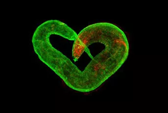 ���x�@΢ע����β�������Ԕ��(x��)��(sh��)�(y��n)���E����aס