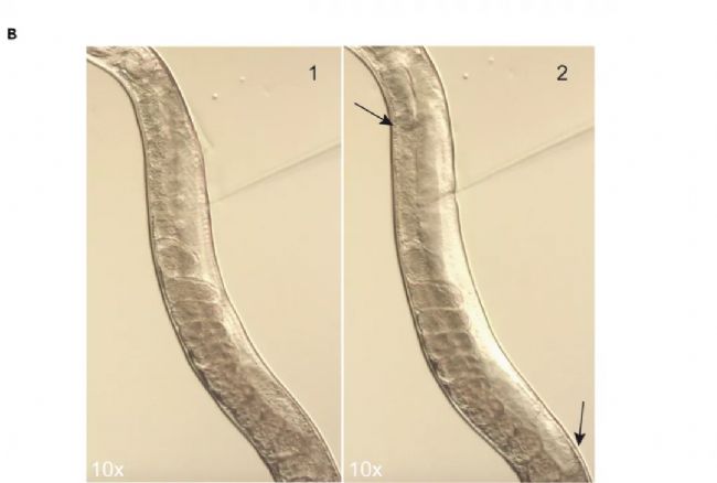 ���x�@΢ע����β�������Ԕ��(x��)��(sh��)�(y��n)���E����aס