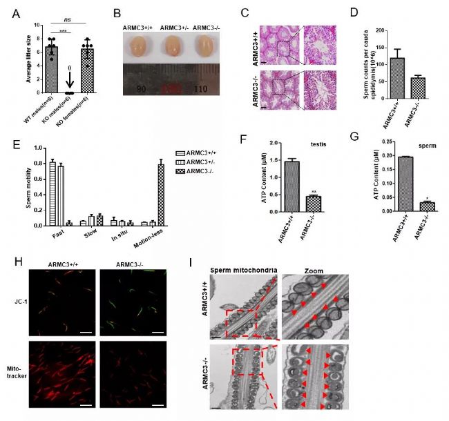 生殖組織特異性自噬