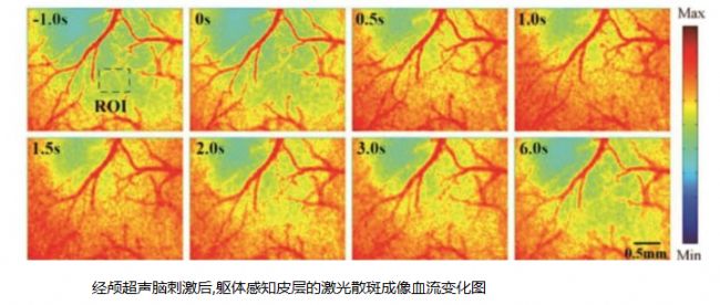 �f��: C:\Users\consentcs\Desktop\1144.png