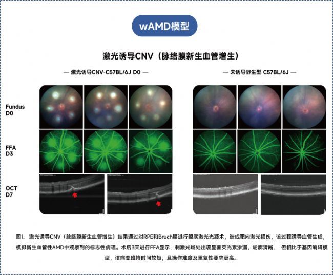 年齡相關(guān)性黃斑變性
