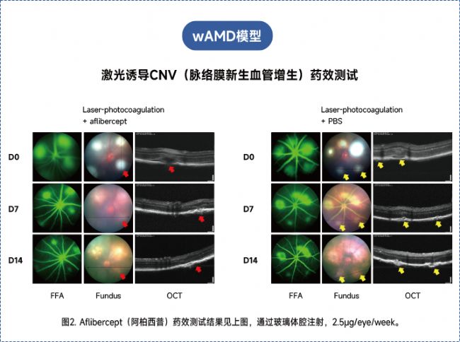 年齡相關(guān)性黃斑變性