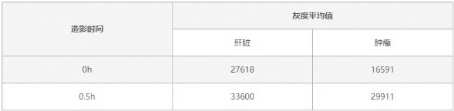 ����MRI(1T)��С��������������Ӌ��