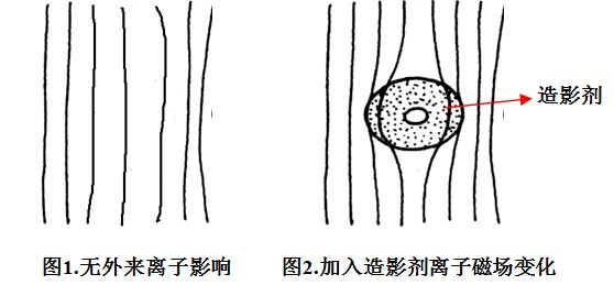 造影劑在磁共振成像的原理及應用