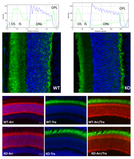 基因治療助力失明者重見光明