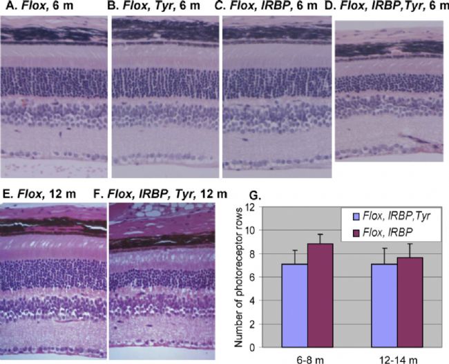 基因治療助力失明者重見光明