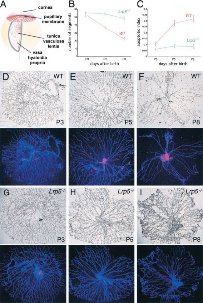 家族性滲出性玻璃體視網(wǎng)膜病變