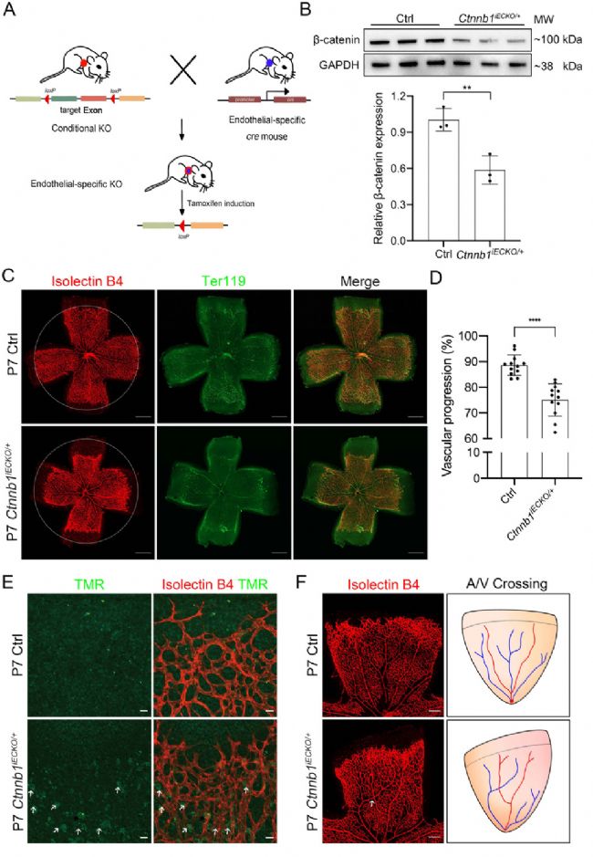 家族性滲出性玻璃體視網(wǎng)膜病變