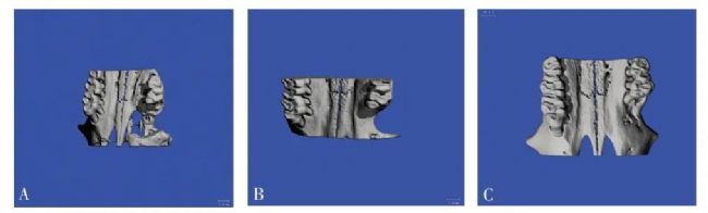 �@΢ CT �^���¹��γ�