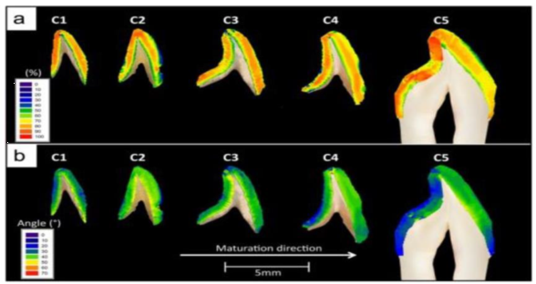 ���@΢ CT �����z�y(c��)���@ʾ�V���|(zh��)���