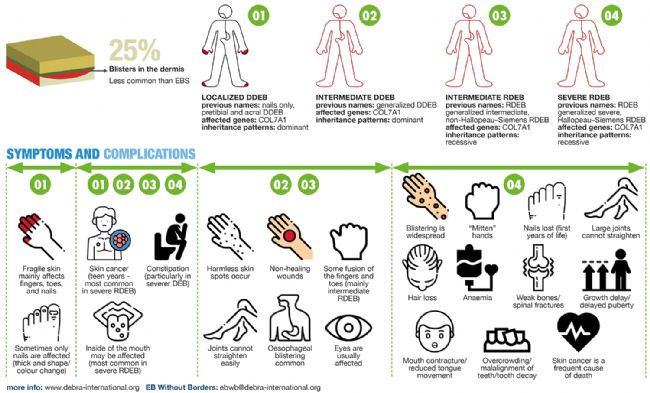 �I(y��ng)�B(y��ng)�����Դ��Ա�Ƥ�ɽ�Y��DEB���о���ģ��