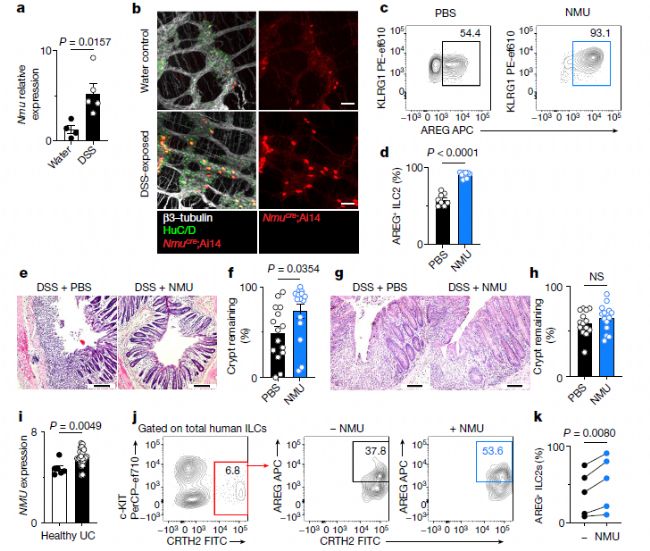 ILC2�ڌ�(du��)�������x(ch��ng)��Ⱦ�ͽM�����o(h��)����l(f��)�]����������