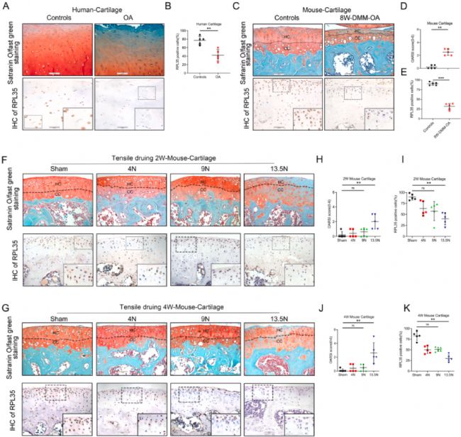 機(jī)械超負(fù)荷下調(diào)核糖體蛋白通過信號(hào)促進(jìn)軟骨細(xì)胞衰老和骨關(guān)節(jié)炎進(jìn)展