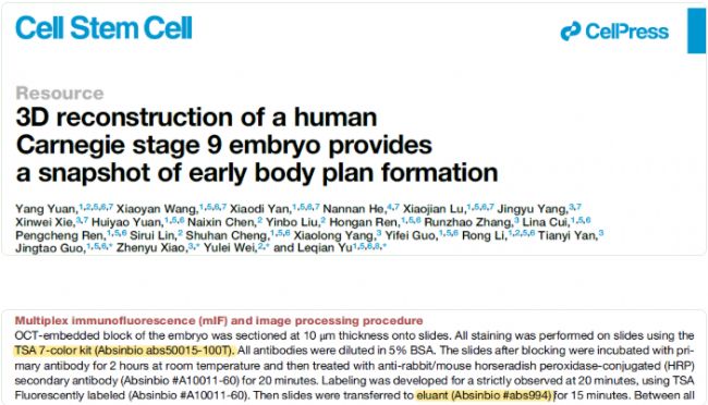 �īI(xi��n)����