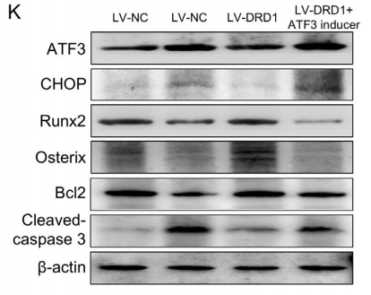 �D5K��ATF3�T��(d��o)����(du��)DRD1�{(di��o)�����õ����D(zhu��n)��WB�Y(ji��)����