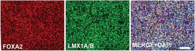 LN111�����B(y��ng)��hESC-DA��FOXA2��LMX1A/B�����ߟɹ�Ⱦɫ�������ߞ�100��m��