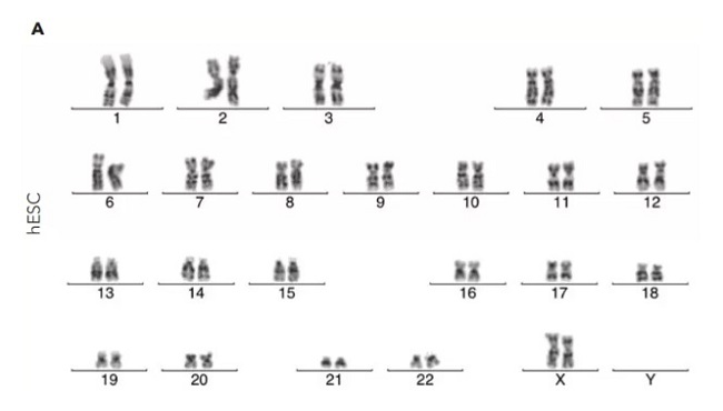 iPSCs��CT521�����B(y��ng)13�΂���������������