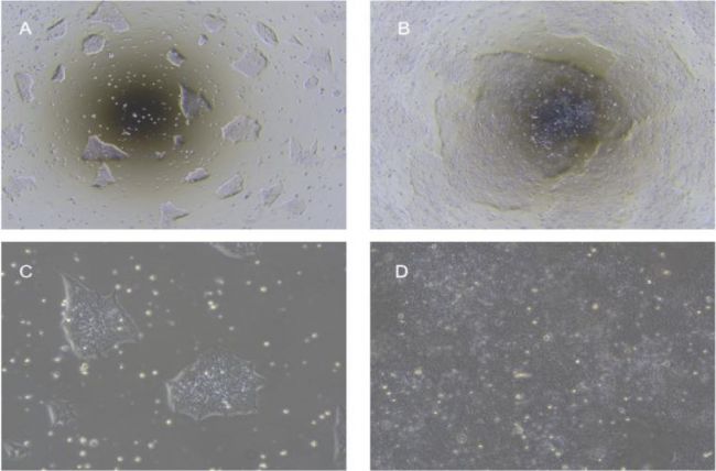 hESC/iPSC��(x��)���ΑB(t��i)�D